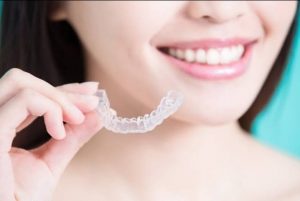 Cost and Alternatives of Invisalign