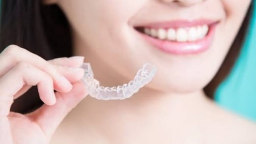 Cost and Alternatives of Invisalign